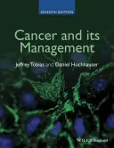 Rak i jego leczenie - Cancer and Its Management