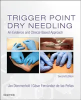 Suche igłowanie punktów spustowych: Podejście oparte na dowodach naukowych i klinicznych - Trigger Point Dry Needling: An Evidence and Clinical-Based Approach