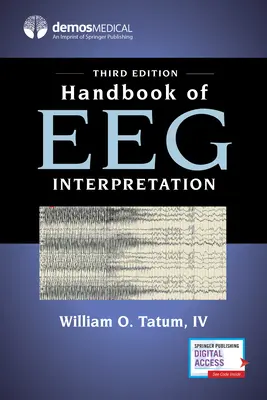 Podręcznik interpretacji zapisu EEG - Handbook of Eeg Interpretation