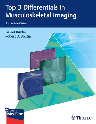 3 najważniejsze różnice w obrazowaniu układu mięśniowo-szkieletowego: Przegląd przypadków - Top 3 Differentials in Musculoskeletal Imaging: A Case Review