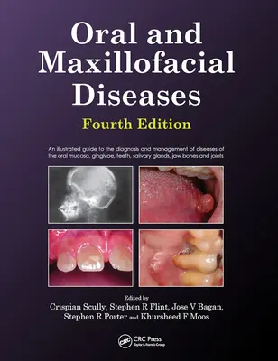 Choroby jamy ustnej i szczękowo-twarzowej, wydanie czwarte - Oral and Maxillofacial Diseases, Fourth Edition