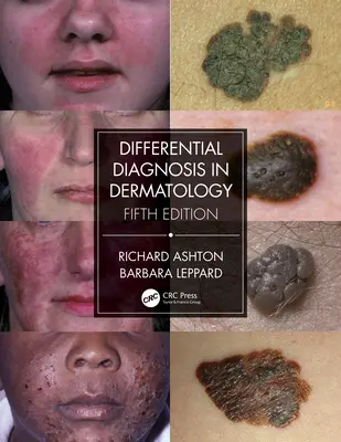 Diagnostyka różnicowa w dermatologii - Differential Diagnosis in Dermatology