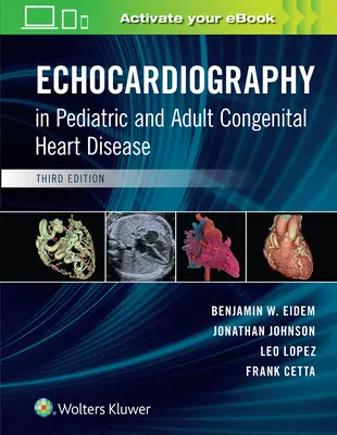 Echokardiografia we wrodzonych wadach serca u dzieci i dorosłych - Echocardiography in Pediatric and Adult Congenital Heart Disease