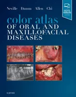 Kolorowy atlas chorób jamy ustnej i szczękowo-twarzowej - Color Atlas of Oral and Maxillofacial Diseases