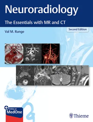 Neuroradiologia: Podstawy MR i TK - Neuroradiology: The Essentials with MR and CT