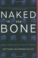 Nagi do szpiku kości: obrazowanie medyczne w XX wieku - Naked to the Bone: Medical Imaging in the Twentieth Century