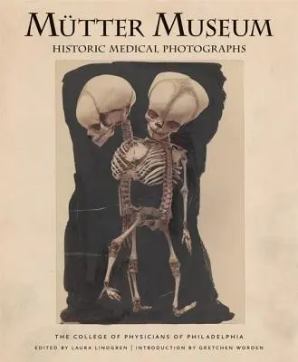 Historyczne fotografie medyczne z muzeum Mtter - Mtter Museum Historic Medical Photographs