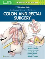 Ilustrowane porady i wskazówki Cleveland Clinic dotyczące chirurgii okrężnicy i odbytnicy - Cleveland Clinic Illustrated Tips and Tricks in Colon and Rectal Surgery