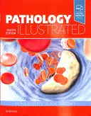 Ilustrowana patologia - Pathology Illustrated