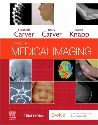 Obrazowanie medyczne Carversa - Carvers' Medical Imaging