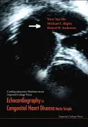 Echokardiografia we wrodzonych wadach serca w prosty sposób - Echocardiography in Congenital Heart Disease Made Simple