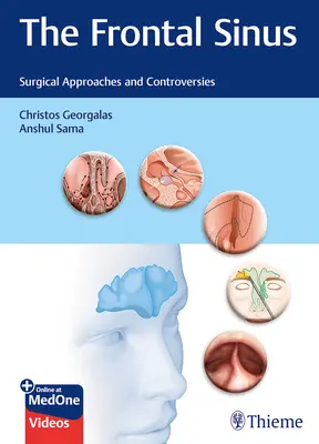 Zatoka czołowa: Podejścia chirurgiczne i kontrowersje - The Frontal Sinus: Surgical Approaches and Controversies