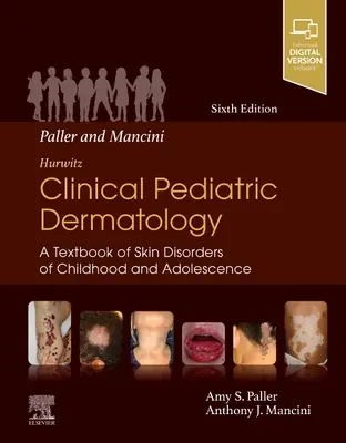 Paller and Mancini - Hurwitz Clinical Pediatric Dermatology: Podręcznik chorób skóry wieku dziecięcego i młodzieńczego - Paller and Mancini - Hurwitz Clinical Pediatric Dermatology: A Textbook of Skin Disorders of Childhood & Adolescence