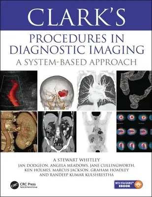 Procedury Clarka w obrazowaniu diagnostycznym - podejście systemowe - Clark's Procedures in Diagnostic Imaging - A System-Based Approach