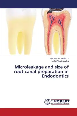 Mikroprzeciek i rozmiar preparacji kanału korzeniowego w endodoncji - Microleakage and size of root canal preparation in Endodontics