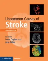 Nietypowe przyczyny udaru mózgu - Uncommon Causes of Stroke