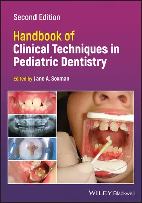 Podręcznik technik klinicznych w stomatologii dziecięcej - Handbook of Clinical Techniques in Pediatric Dentistry