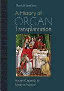 Historia transplantacji narządów: Od starożytnych legend do współczesnej praktyki - A History of Organ Transplantation: Ancient Legends to Modern Practice