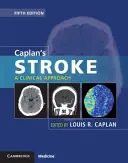 Caplan's Stroke: Podejście kliniczne - Caplan's Stroke: A Clinical Approach