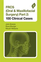 Frcs (chirurgia jamy ustnej i szczękowo-twarzowej) część 2: 100 przypadków klinicznych - Frcs (Oral & Maxillofacial Surgery) Part 2: 100 Clinical Cases