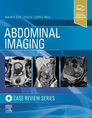 Obrazowanie jamy brzusznej: Case Review Series - Abdominal Imaging: Case Review Series