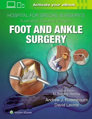 Ilustrowane porady i wskazówki dotyczące chirurgii stóp i kostek w Hospital for Special Surgery - Hospital for Special Surgery's Illustrated Tips and Tricks in Foot and Ankle Surgery