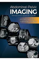 Obrazowanie jamy brzusznej i miednicy - 200 przypadków (powszechne choroby): USG, TK i MRI - Abdominal-Pelvic Imaging - 200 Cases (Common Diseases): US, CT and MRI