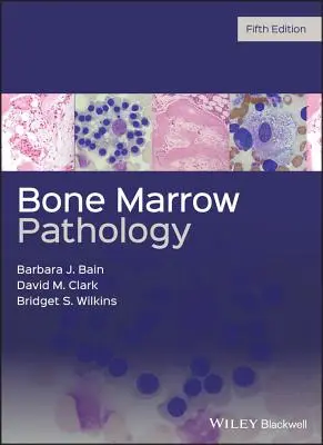 Patologia szpiku kostnego - Bone Marrow Pathology