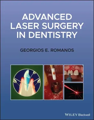 Zaawansowana chirurgia laserowa w stomatologii - Advanced Laser Surgery in Dentistry