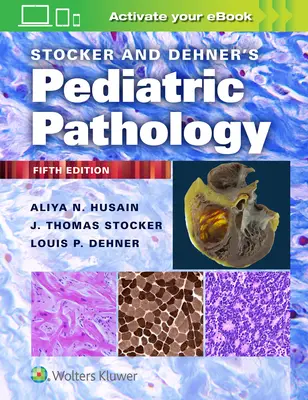 Patologia dziecięca Stockera i Dehnera - Stocker and Dehner's Pediatric Pathology