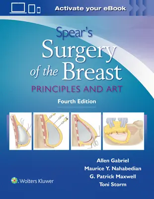 Spear's Surgery of the Breast: Zasady i sztuka - Spear's Surgery of the Breast: Principles and Art