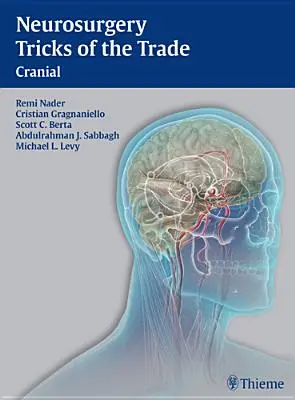 Sztuczki neurochirurgiczne - czaszka: Czaszka - Neurosurgery Tricks of the Trade - Cranial: Cranial