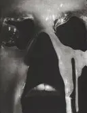 Mizofonia - Misophonia