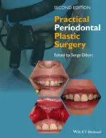 Praktyczna chirurgia plastyczna przyzębia - Practical Periodontal Plastic Surgery