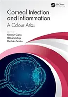 Zakażenie i zapalenie rogówki: A Colour Atlas - Corneal Infection and Inflammation: A Colour Atlas