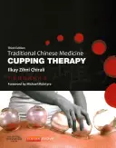 Terapia bańkami tradycyjnej medycyny chińskiej - Traditional Chinese Medicine Cupping Therapy