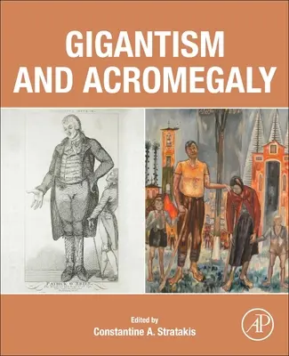 Gigantyzm i akromegalia - Gigantism and Acromegaly