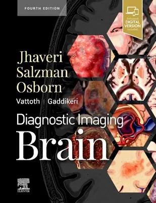 Obrazowanie diagnostyczne: Mózg - Diagnostic Imaging: Brain