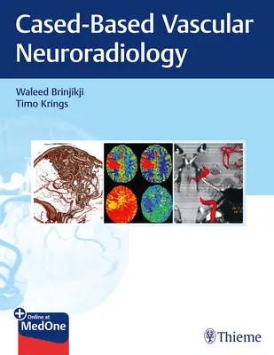 Obrazowanie w chorobach układu nerwowo-naczyniowego: Podejście oparte na przypadkach - Imaging in Neurovascular Disease: A Case-Based Approach