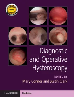 Histeroskopia diagnostyczna i operacyjna - Diagnostic and Operative Hysteroscopy