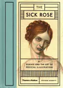 Chora róża - albo choroba i sztuka ilustracji medycznej - Sick Rose - Or; Disease and the Art of Medical Illustration