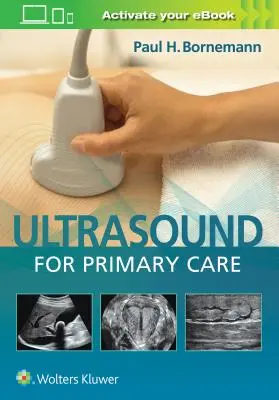 Ultrasonografia dla podstawowej opieki zdrowotnej [z eBookiem] - Ultrasound for Primary Care [With eBook]