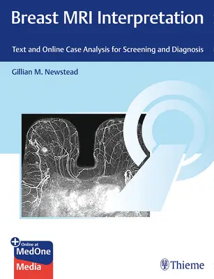 Interpretacja rezonansu magnetycznego piersi: Tekst i analiza przypadków online na potrzeby badań przesiewowych i diagnostyki - Breast MRI Interpretation: Text and Online Case Analysis for Screening and Diagnosis