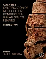 Ortner's Identification of Pathological Conditions in Human Skeletal Remains (Identyfikacja stanów patologicznych w ludzkich szczątkach szkieletowych) - Ortner's Identification of Pathological Conditions in Human Skeletal Remains