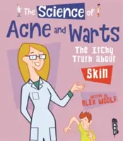 Nauka o trądziku i brodawkach - swędząca prawda o skórze - Science Of Acne & Warts - The Itchy Truth About Skin