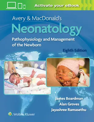 Neonatologia Avery'ego i Macdonalda: Patofizjologia i postępowanie z noworodkiem - Avery & Macdonald's Neonatology: Pathophysiology and Management of the Newborn