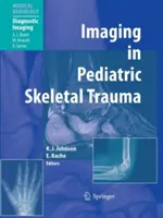 Obrazowanie w pediatrycznych urazach szkieletowych: Techniki i zastosowania - Imaging in Pediatric Skeletal Trauma: Techniques and Applications