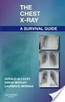 The Chest X-Ray: A Survival Guide