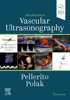 Wprowadzenie do ultrasonografii naczyniowej - Introduction to Vascular Ultrasonography