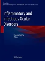 Zapalne i zakaźne choroby oczu - Inflammatory and Infectious Ocular Disorders